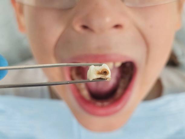 Best Orthodontic Emergency Dentist in Riner, VA