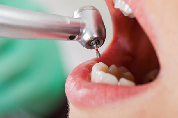 Best Orthodontic Emergency Dentist in Riner, VA